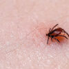 Tick-Borne Disease Strikes Thousands in West Virginia