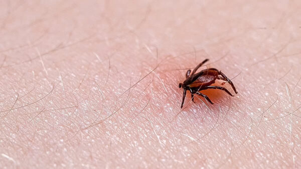 Tick-Borne Disease Strikes Thousands in West Virginia