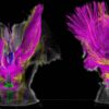 Scientists Find What Could Explain Altered States of Consciousness on MRI Scans