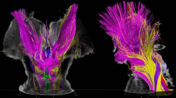 Scientists Find What Could Explain Altered States of Consciousness on MRI Scans