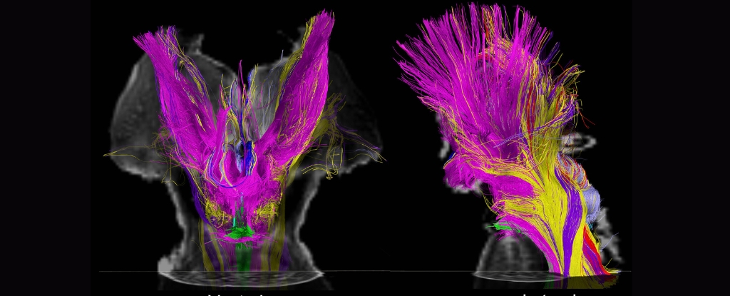 Scientists Find What Could Explain Altered States of Consciousness on MRI Scans